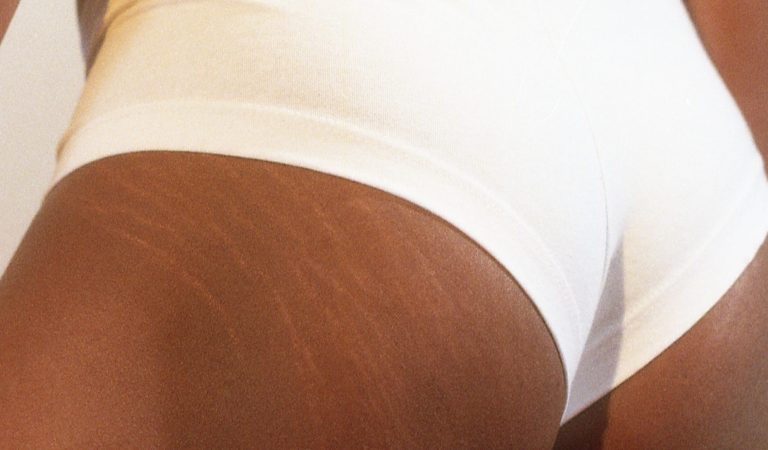 When Your Butt Says Surprise: A Cheeky Guide to Anal Adventures!