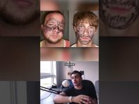 Man discusses funny facial drawing incidents.