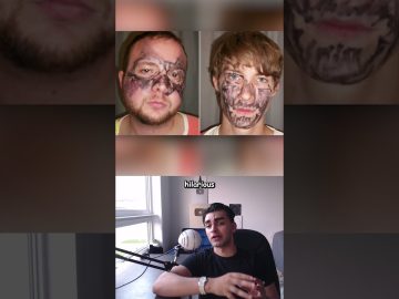 Man discusses funny facial drawing incidents.